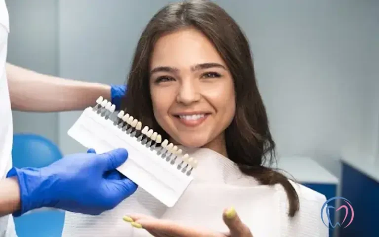 Dental Veneers - Everything You Need to Know