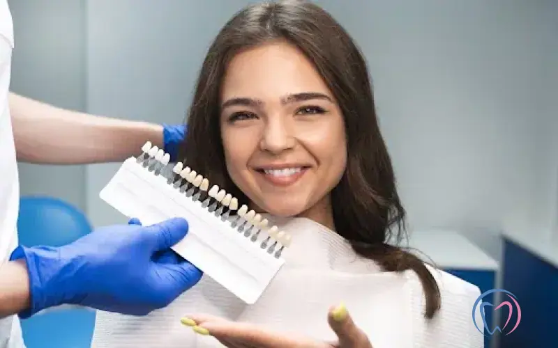 Dental Veneers - Everything You Need to Know