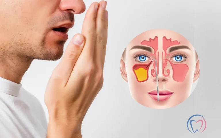 How To Treat Bad Breath Caused By Sinus