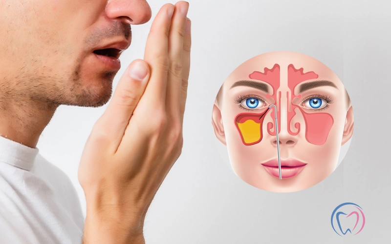 How To Treat Bad Breath Caused By Sinus