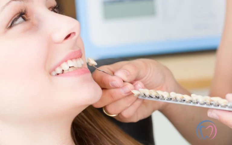 Same Day Veneers_ Everything You Need to Know