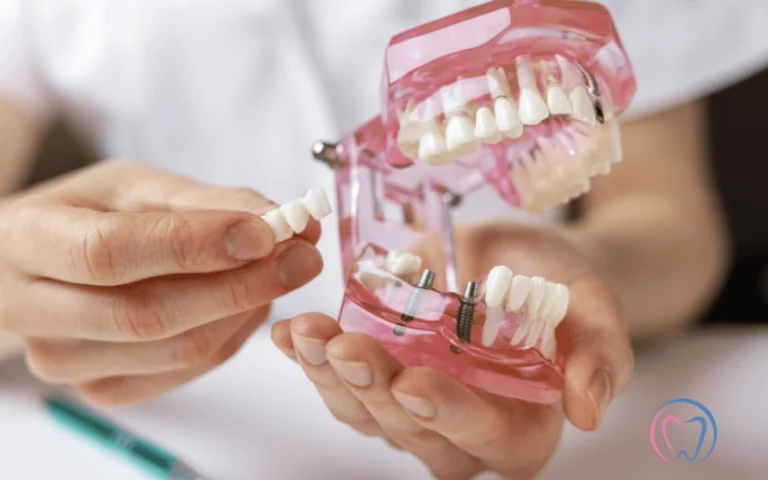 Can Implant Support Dentures Be Removed_