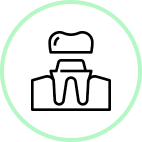 Dental Crowns & Bridges
