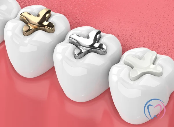 Dental Fillings