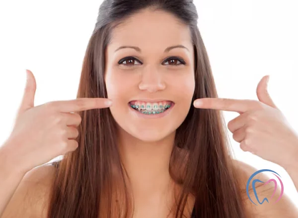 Teeth Straightening